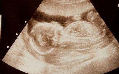 甘肃三代试管婴儿费用全解析：详细参考明细让您心里有数，合理规划花费