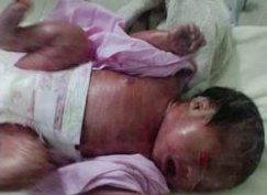 茂名市人民医院试管婴儿造娃价格明细参考