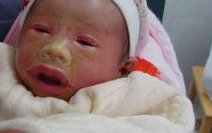 高龄妈妈做试着床成功率怎么提高？4个妙招助你圆梦！