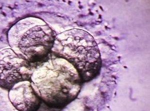 RFG技术如何帮助患者通过试管婴儿成功怀孕？